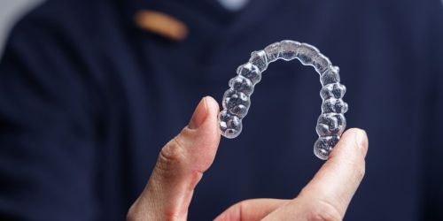Mascherine per denti trasparenti