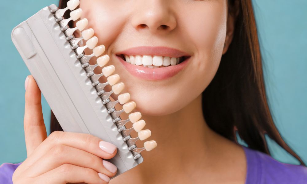 faccetta dentale blog Protesica