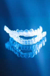 Impianto dentale centri Protesica a Milano, Madone, Cassano d’Adda Mascherine per denti trasparenti
