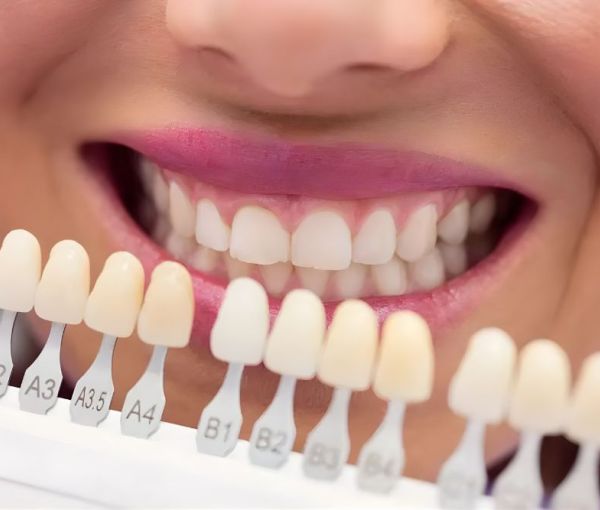 igiene orale e prevenzione protesica